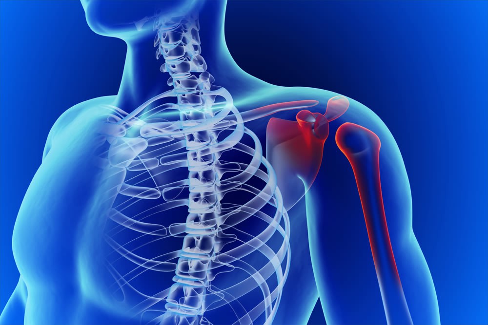 $300,000.00 – For a man who had an arthroscopic surgery to his shoulder as a result of a motor vehicle incident that occurred while he was making a left hand turn