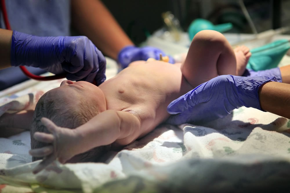 New York Family Compensated for Daughter’s Birth Injury - Medical Malpractice